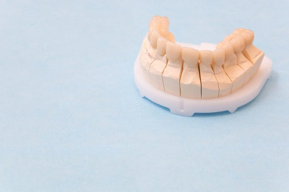 Tandkronen bij Multi Dental in Scheveningen